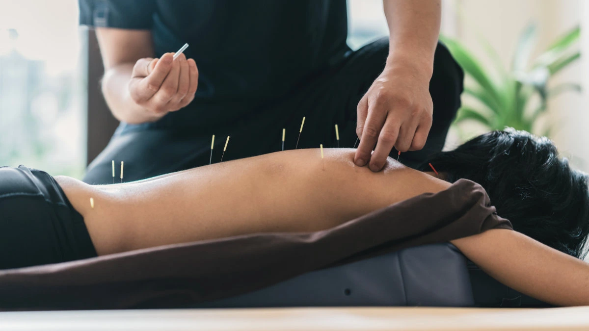 Acupuncture therapy across length of back