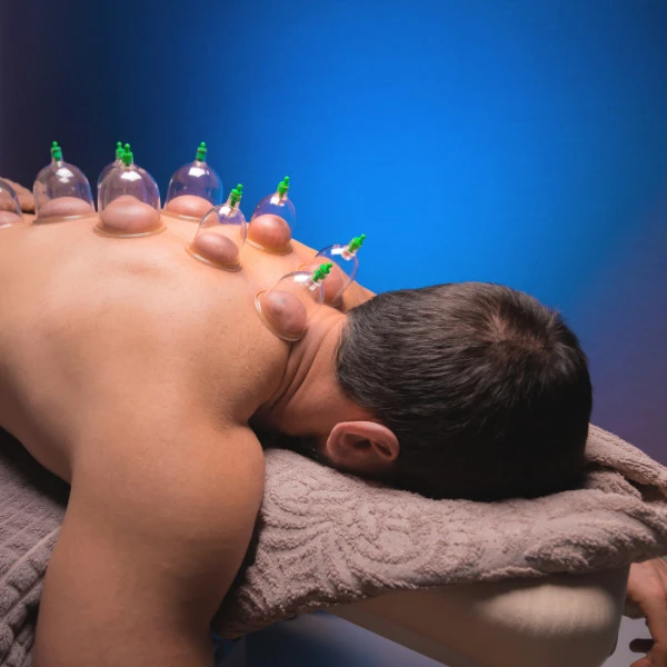 Man receiving cupping therapy along upper back
